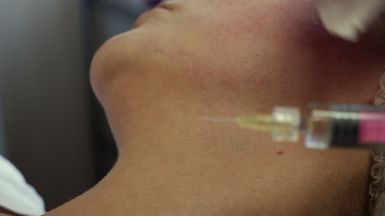 화장품 주사 절차