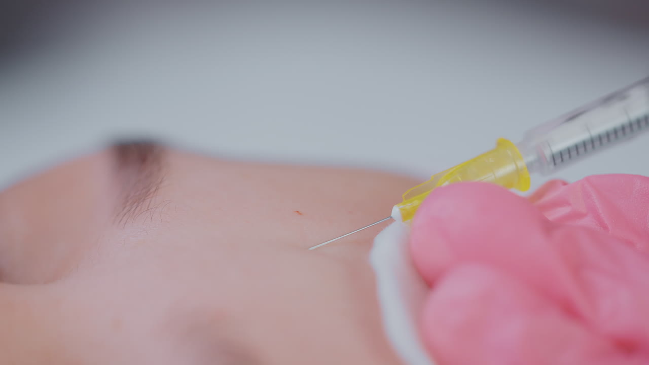 procedimiento de inyección facial