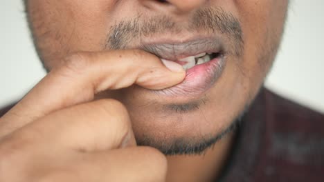 hombre mordiendo uñas