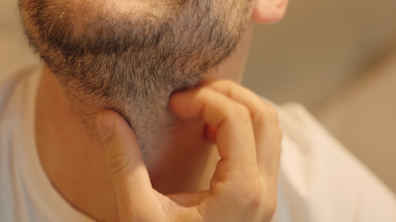 Close-up of a man scratching his itchy beard and neck area. Concept for skin irritation, grooming issues, or beard care and hygiene
