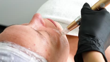 microneedling facial treatment: skin rejuvenation and anti-aging procedure