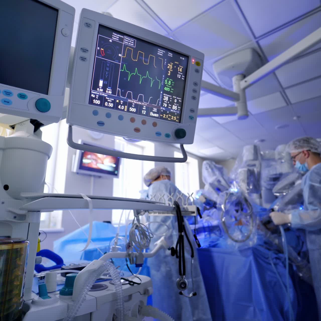 Schermo di un monitor che mostra i segni vitali di un paziente. Chirurgia robotica minimamente invasiva con il sistema robotico