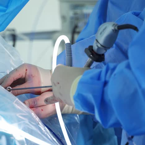 modern surgical operating room. team of surgeons in operating theater performing operation on patient