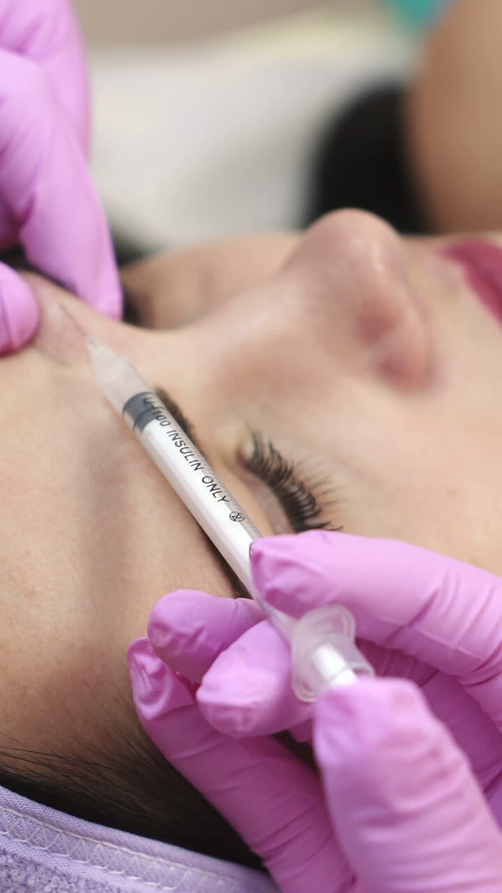Rejuvenating facial injections. Vertical video