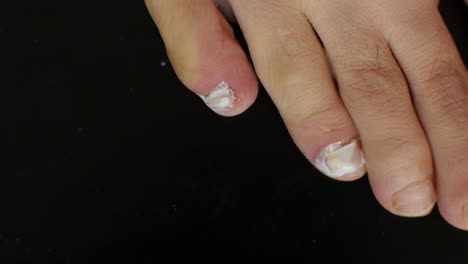 anti-fungal nail treatment being applied to a pinky toe against a black background