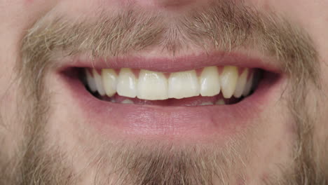 Cerrar-Hombre-Boca-Sonriendo-Feliz-Vello-Facial-Barba-Dientes-Sanos-Concepto-De-Salud-Dental