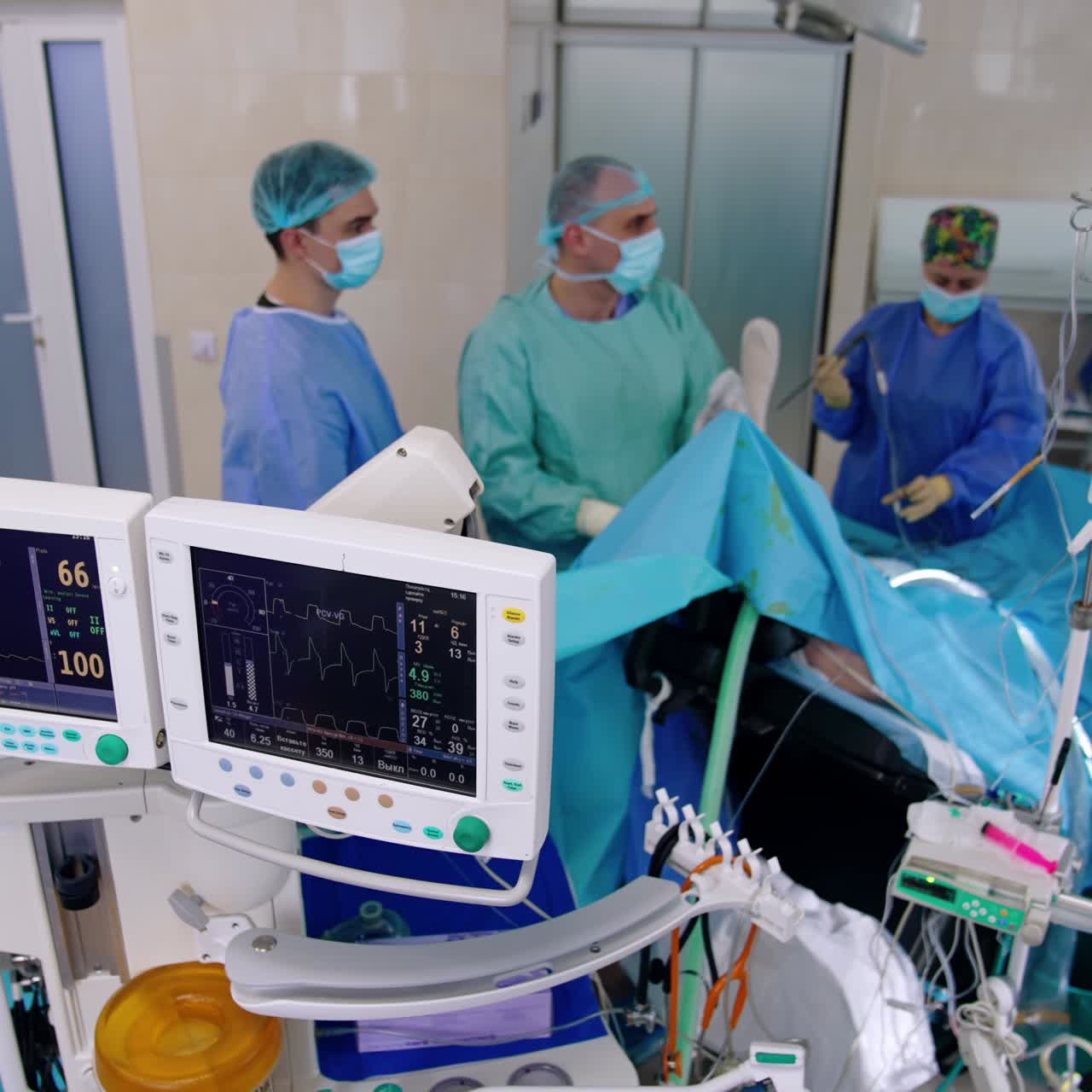 Un chirurgo assistito da un medico e un'infermiera esegue un intervento. Due monitor del ventilatore polmonare mostrano i parametri vitali di un paziente. Vista dall'alto