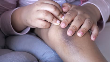 toddler with a bruise on their knee