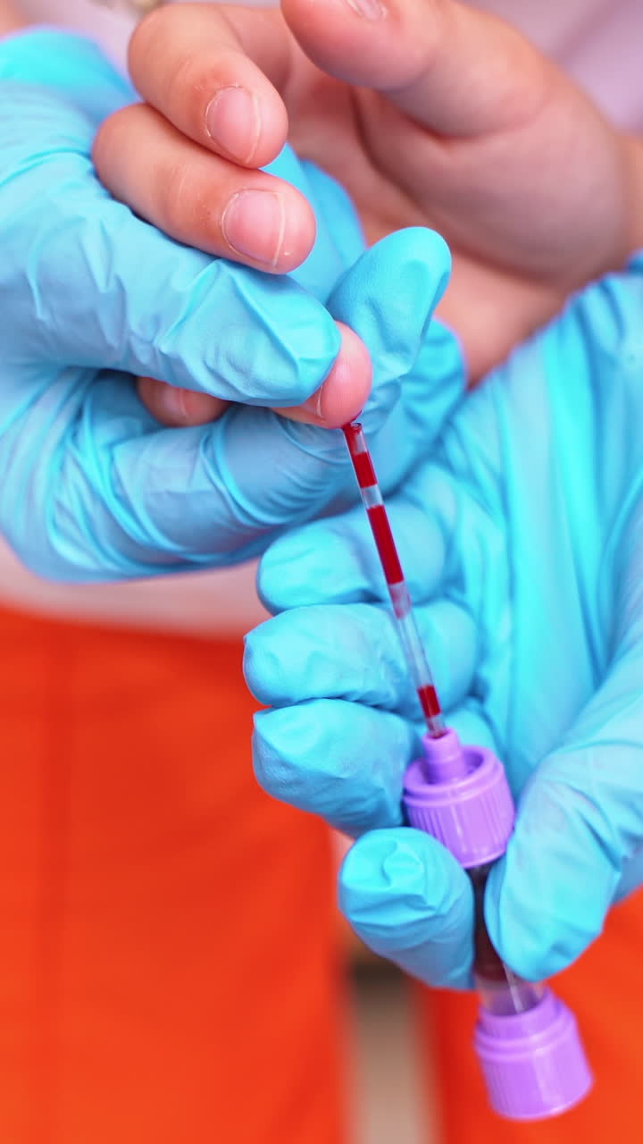 Female nurse taking blood into vial. Hands in sterile blue gloves of a medical worker collect blood from patient's finger. Close-up. Vertical video