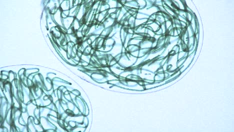 vista microscópica de sacos o burbujas que contienen cadenas de algas verdes azules