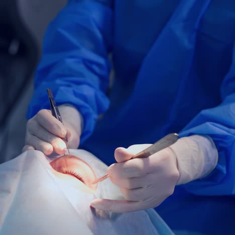 endoscopic eye surgery