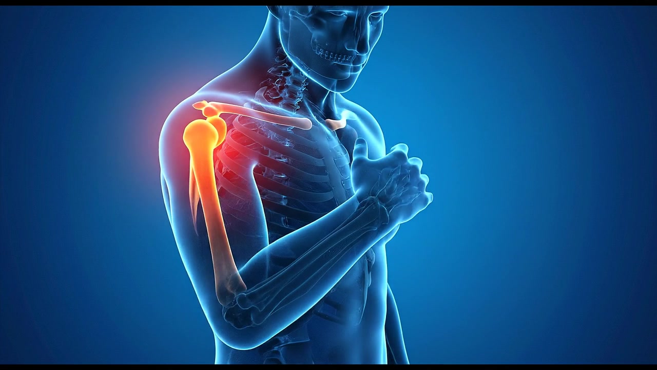 Illustrazione dell'anatomia del corpo umano che mostra un forte dolore e infiammazione alla spalla con un effetto di articolazione luminosa e brillante.