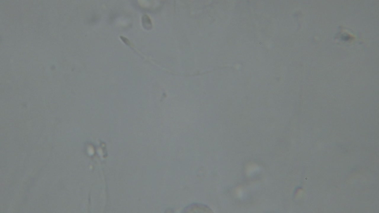 Microscopic view of moving human sperm cells with visible heads and flagella against a light background, commonly used in fertility and reproductive studies
