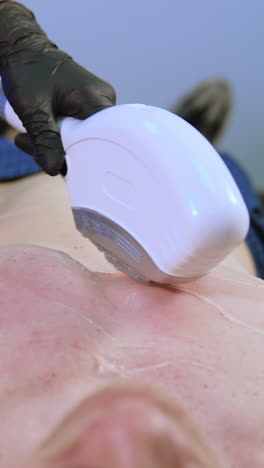 Hair removing process on male chest. Beauty specialist moves laser equipment by the body of a client. Vertical video