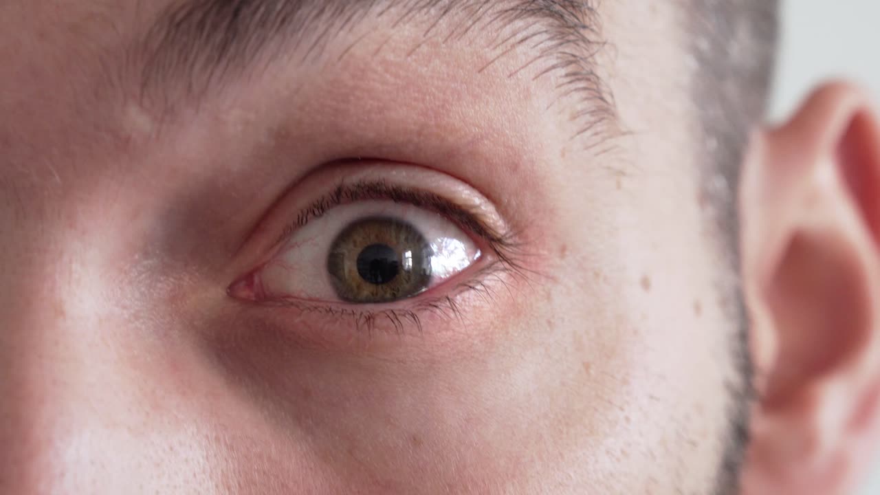 카메라를 들여다보는 적목 현상, 근접 촬영