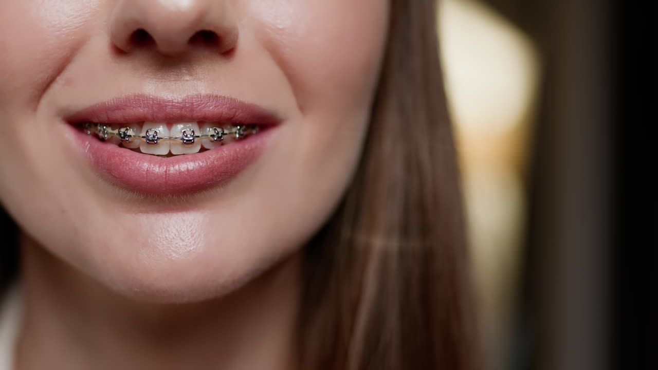 Woman with Braces