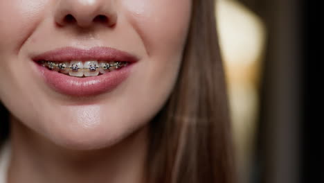 woman with braces