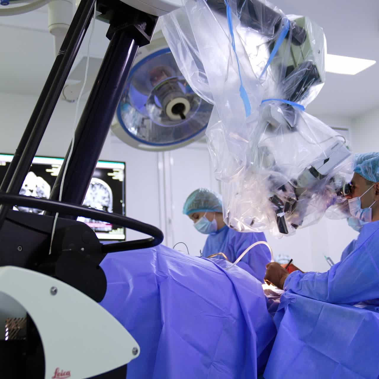 Mid-aged male surgeon sit near the patient looking at microscope. Neurosurgeon performs operation on brain