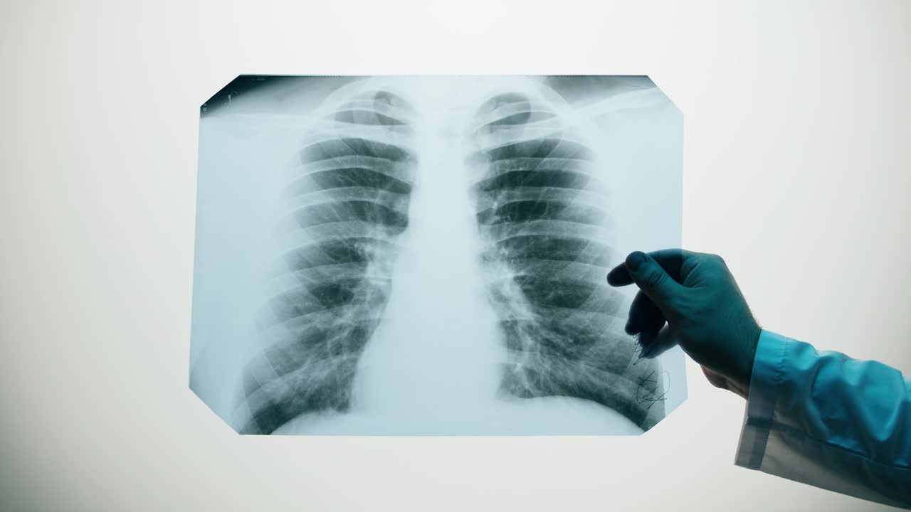 Medico che esamina una radiografia del torace umano su un diafanoscopio