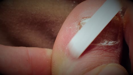 macro shot: filing down a fungal-infected big toe nail