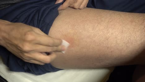 alcohol wipe cleaning subcutaneous injection site upper thigh