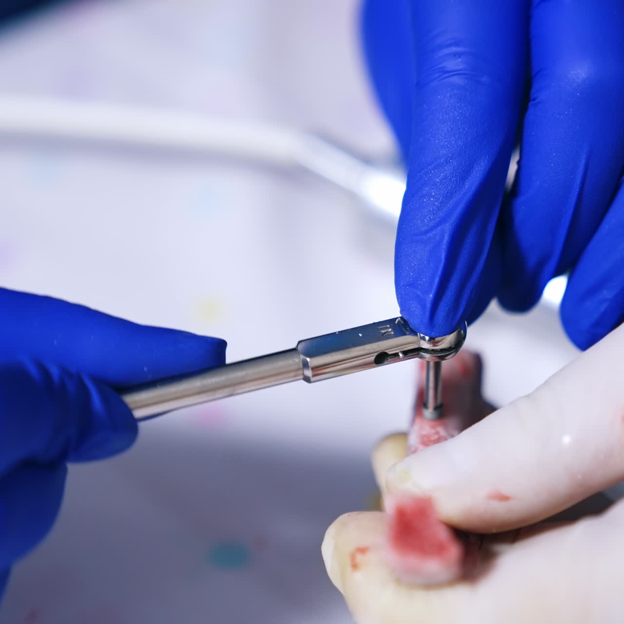 Mani con guanti in lattice stringono una vite con un utensile in metallo. Primo piano. Corso di odontoiatria in una scuola di medicina