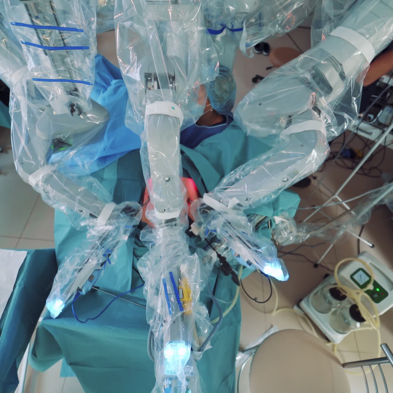 Da Vinci Surgery. Medical operation involving robot. Future of Medicine
