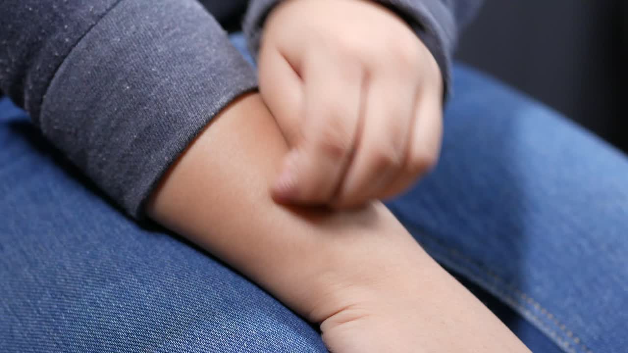 Child scratching arm