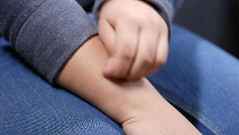 child scratching arm