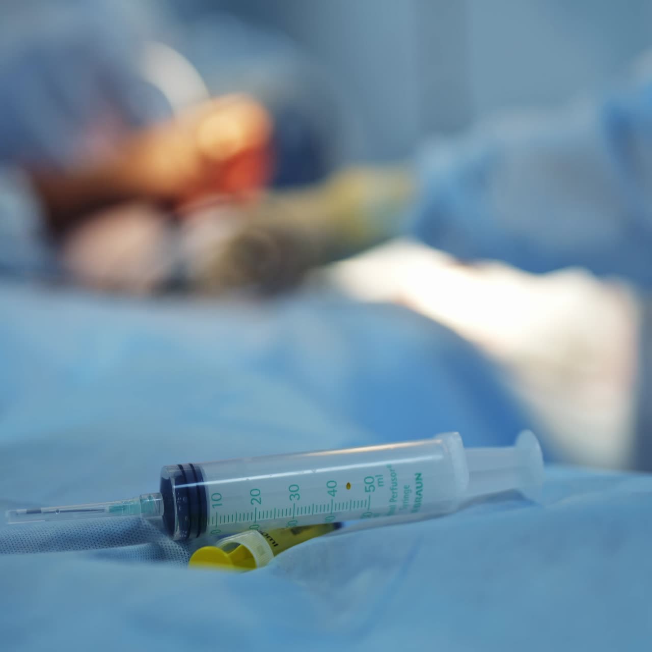 Siringa giace sul tavolo operatorio. L'equipe di neurochirurgia esegue l'intervento sullo sfondo sfocato. Primo piano.
