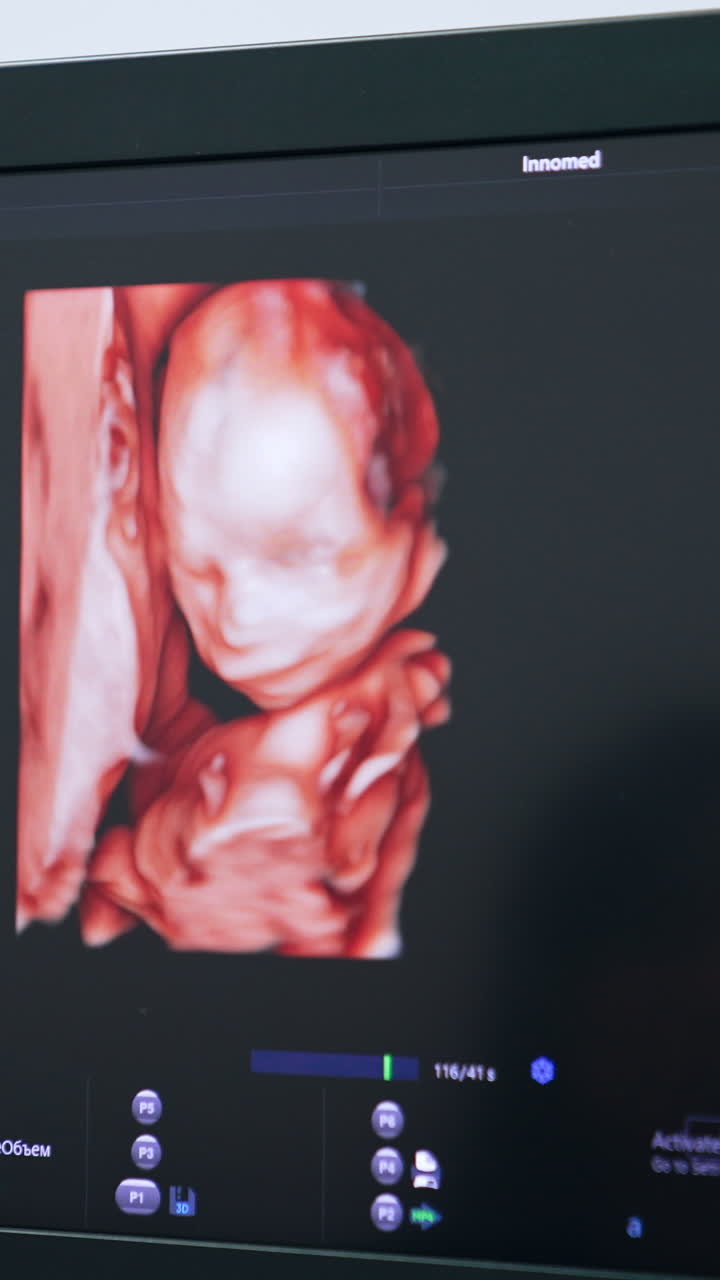 Image of a child in mom's womb on the monitor of ultrasound machine. Checking the baby development on the ultrasonic equipment. Close up. Vertical video