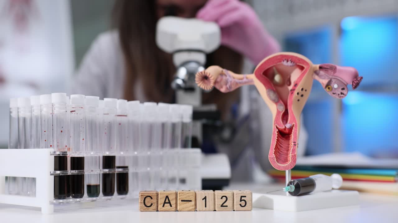 Test del marker tumorale CA-125 in laboratorio medico con modello di utero