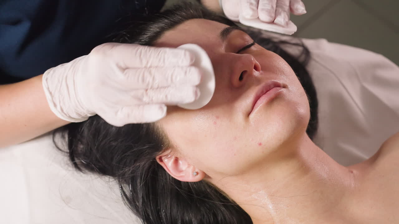 Close up of massage therapist hands applying wool pads to white lady face while she closes eyes peacefully, showing soothing facial cleansing in bright spa clinic with natural lighting