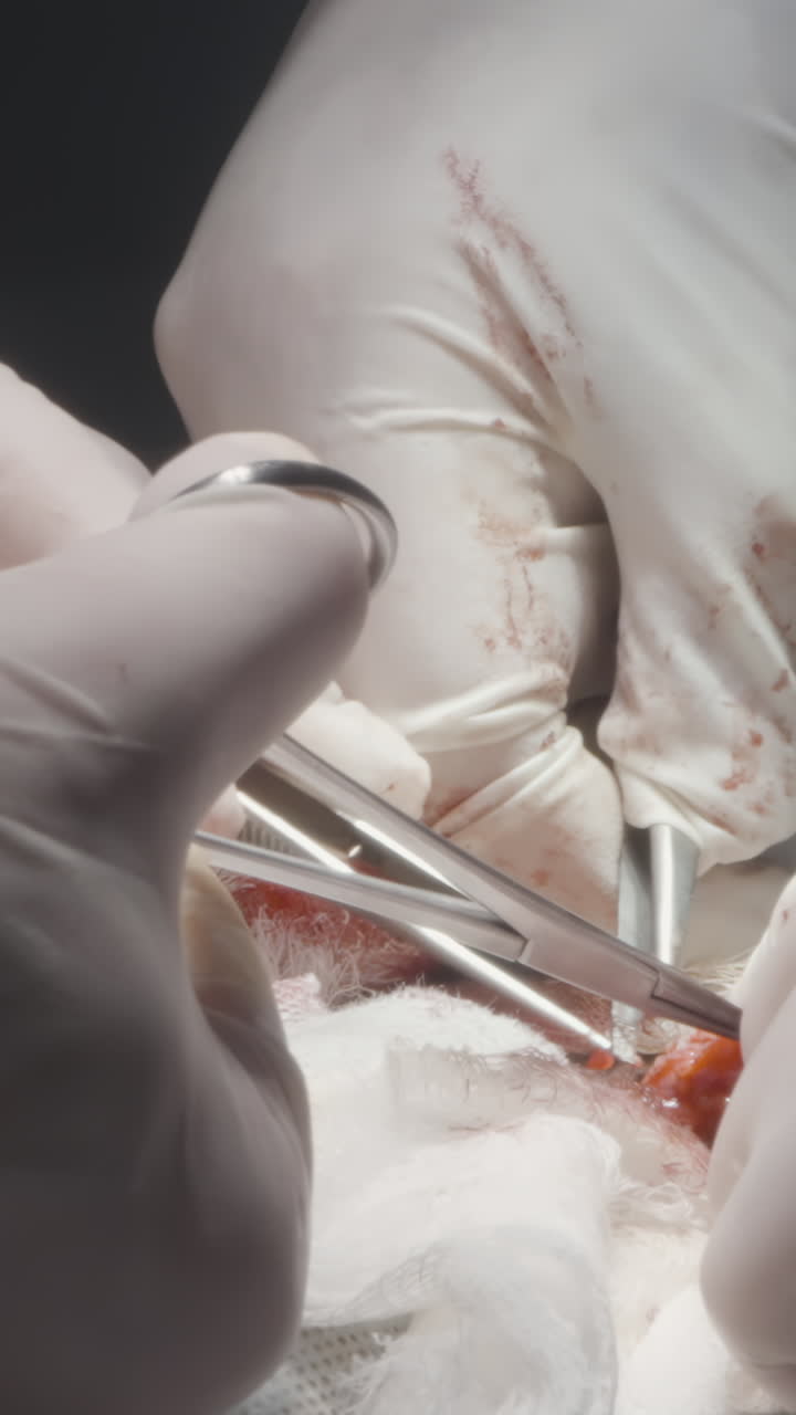 procedimiento quirúrgico