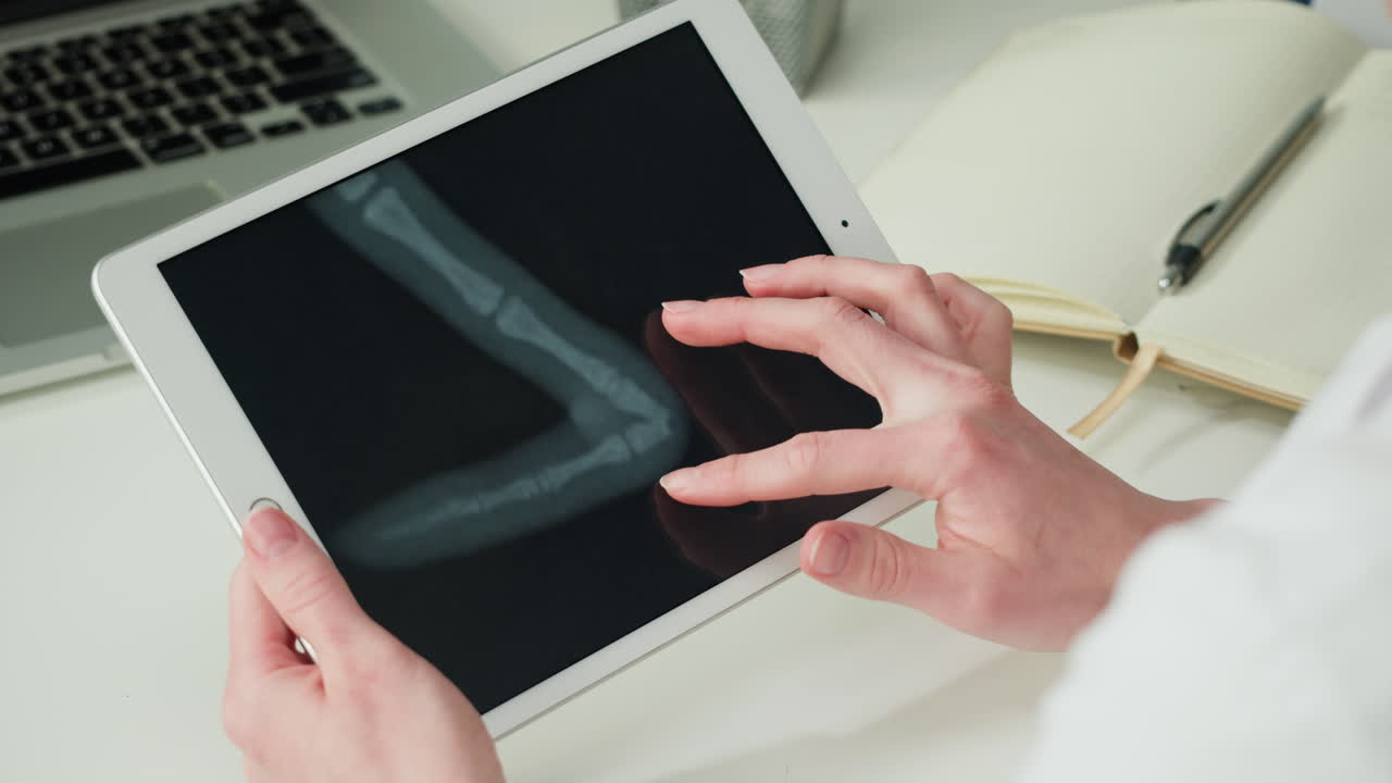 Doctor reviewing foot X-ray on tablet