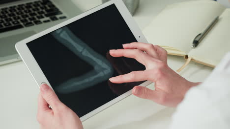 doctor reviewing foot x-ray on tablet
