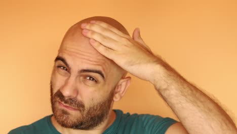 hombre calvo barbudo quemado por el sol, frotándose la cabeza donde la piel se está desprendendo
