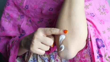 woman applying cream to her elbow