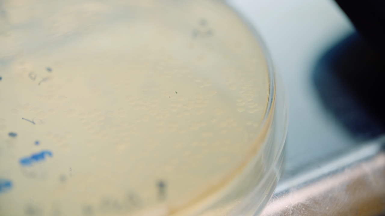 científico mirando bacterias en placa de petri en el laboratorio 3