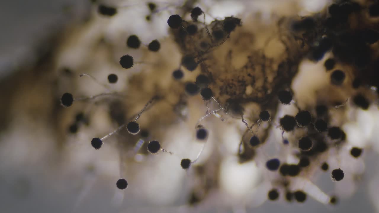hongos aspergillus niger moho grupo denso bajo microscopio vista oscura