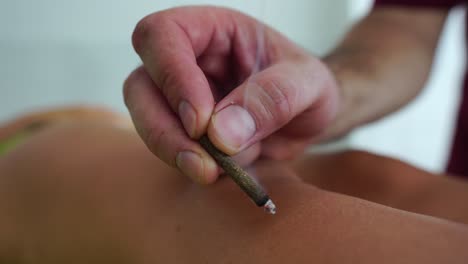 therapist performing moxibustion procedure at health center. moxibustion is a thermal effect on biologically active points located across the entire surface of the human body