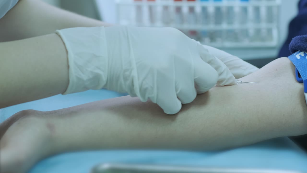 colección de sangre, enfermera tomando una muestra de sangre para el análisis. enfermera tomando una prueba de sangre para exámenes médicos. el médico o la enfermera tomará una muestra de sangue de una vena para la prueba.