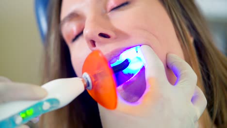 teeth whitening procedure