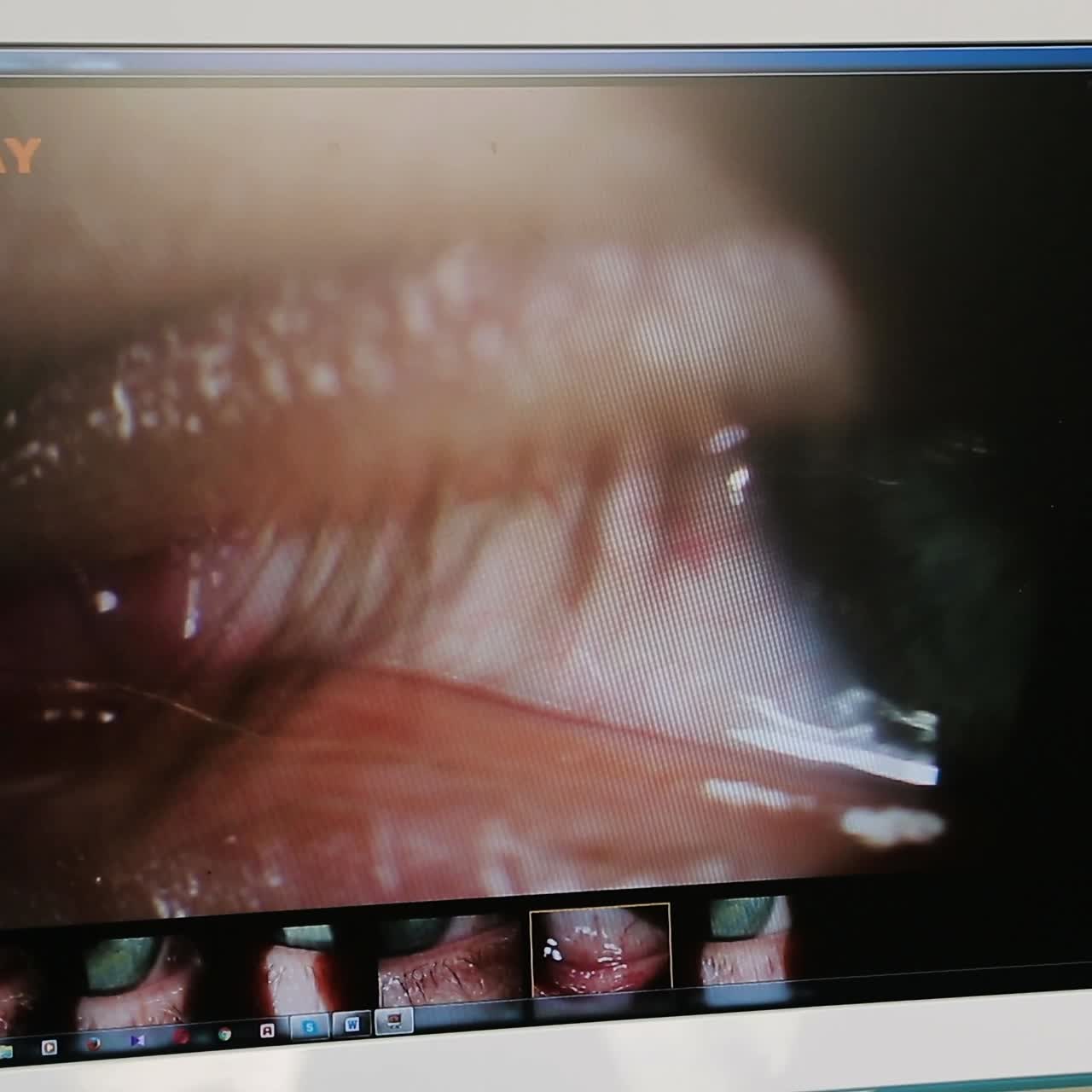 moderno dispositivo di prova oculare