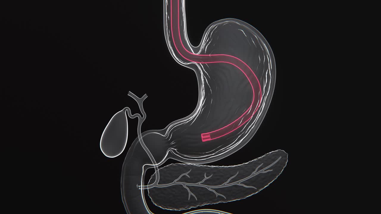 Detailed Xray video of medical illustration depicting a gastroscopy procedure used to visually examine the stomach | Gastroscopy Video in 4K