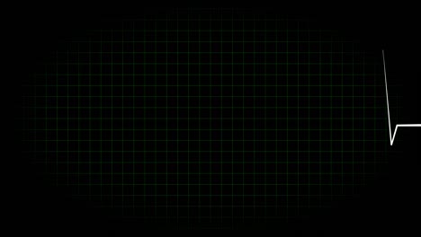 electrocardiograma osciloscopio forma de onda animación gráficos de movimiento