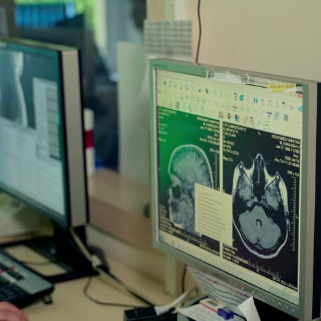 doctor explaining x-ray