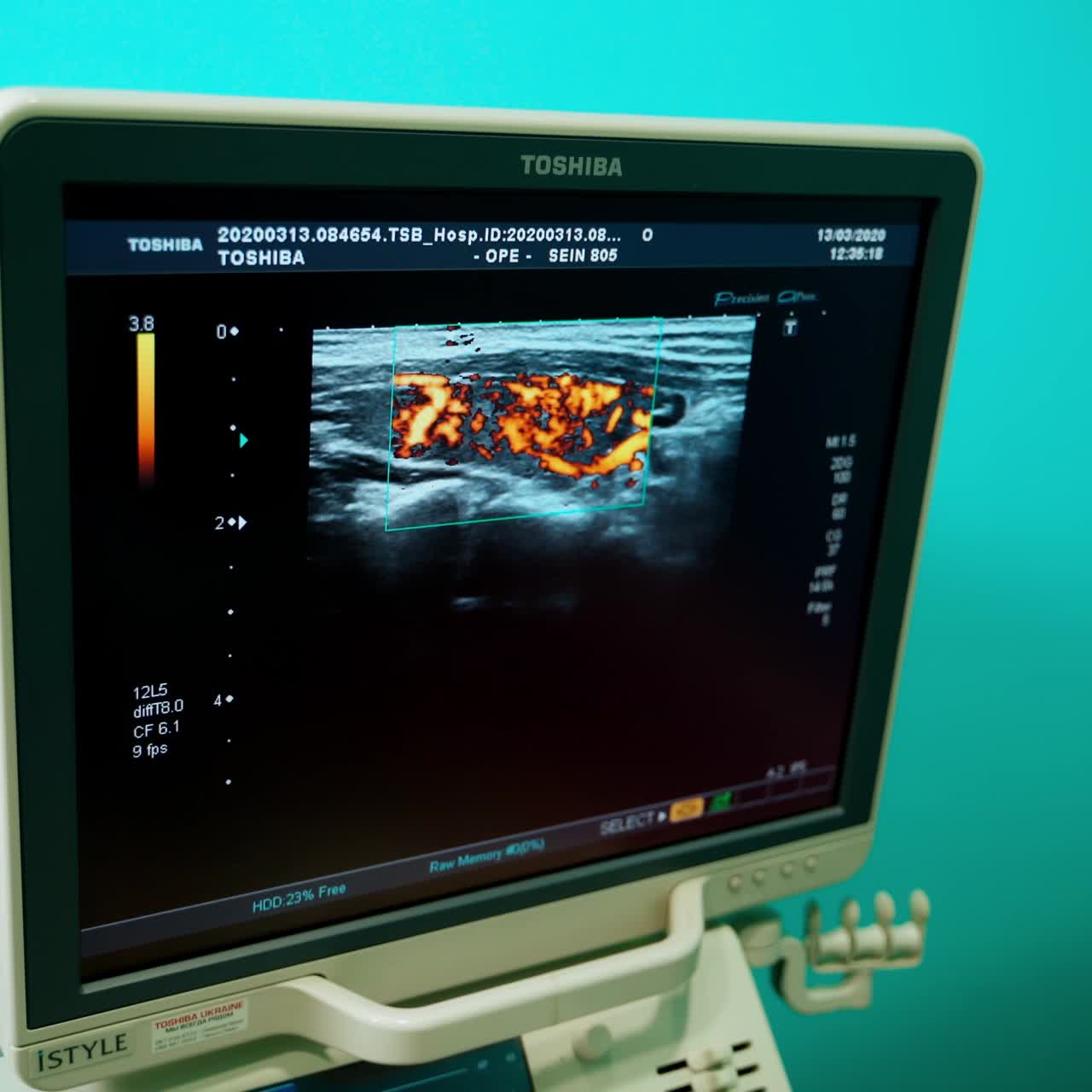 Medico che esamina la tiroide del paziente. Esame della tiroide del paziente con ecografia in una clinica medica