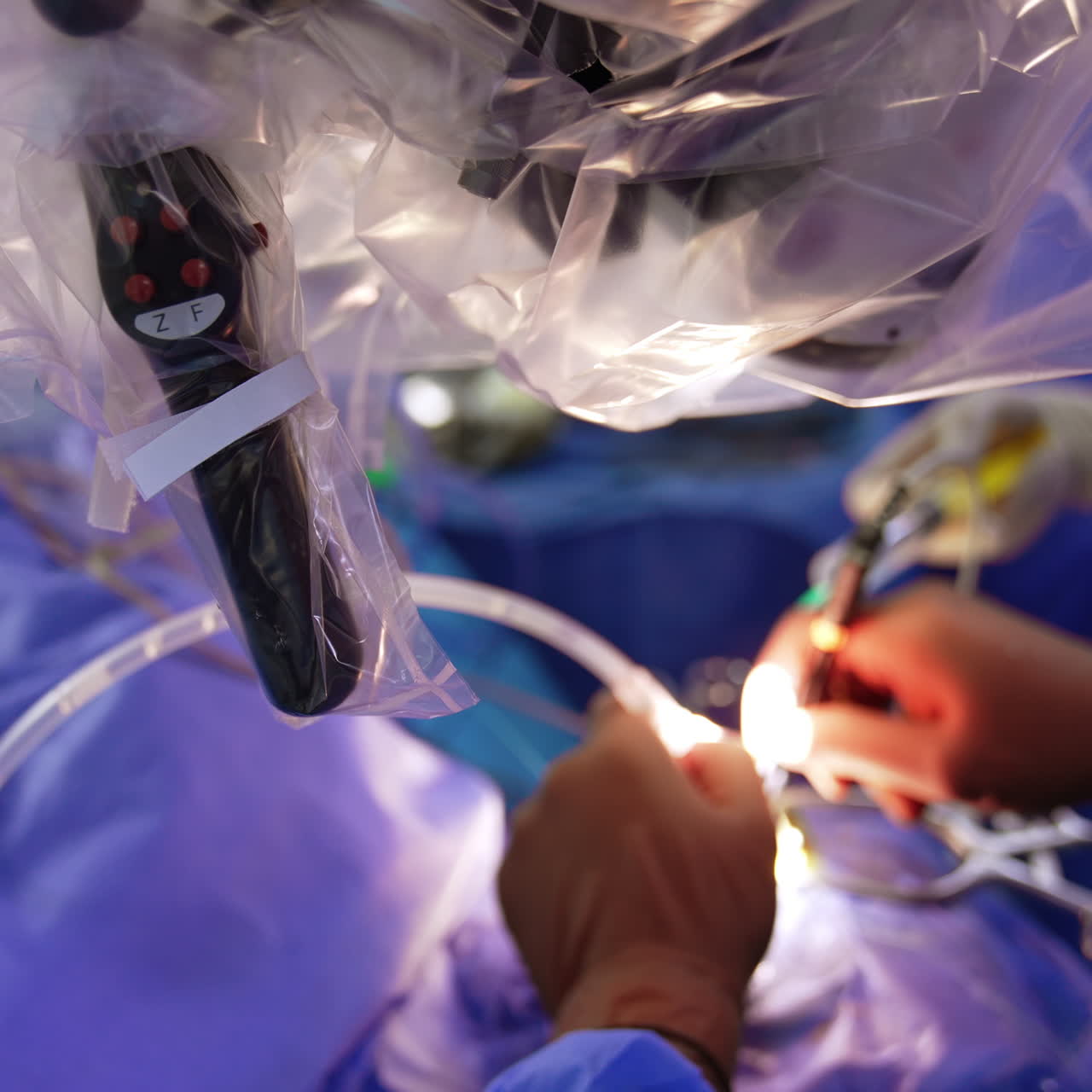 Hands of medics in latex gloves perform operation under the microscope. Close up. Neurosurgical procedure in progress.