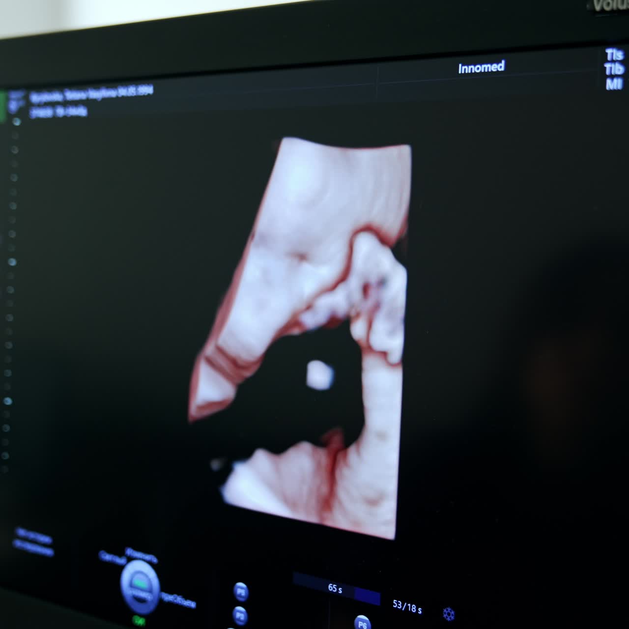 Monitor con immagine di un feto su un'apparecchiatura ecografica. Esame ecografico per donna incinta. Primo piano